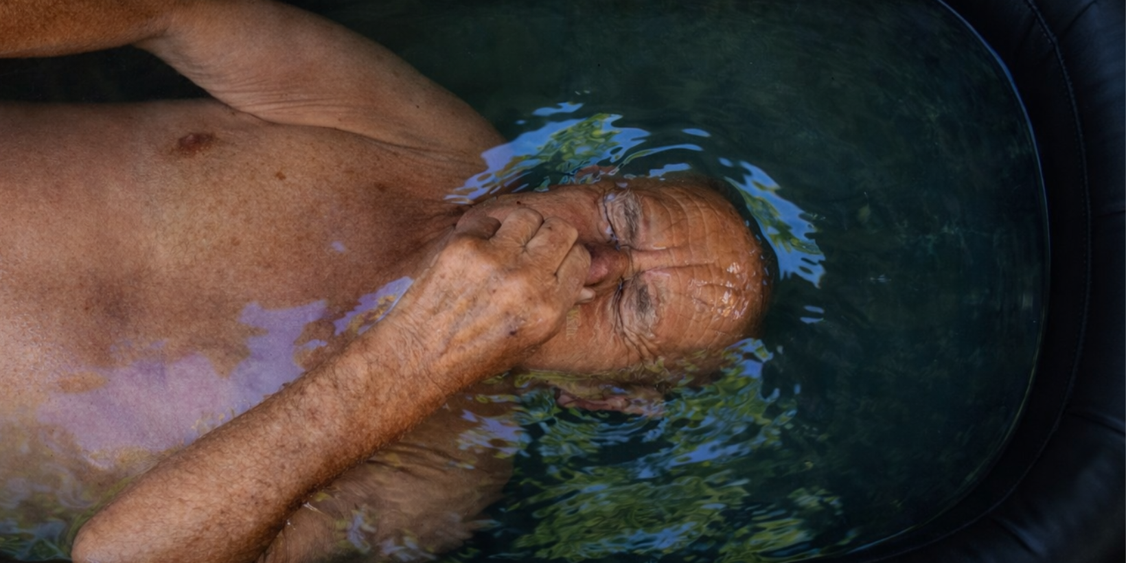 ¿Por qué hacer crioterapia si tenés más de 40 años?