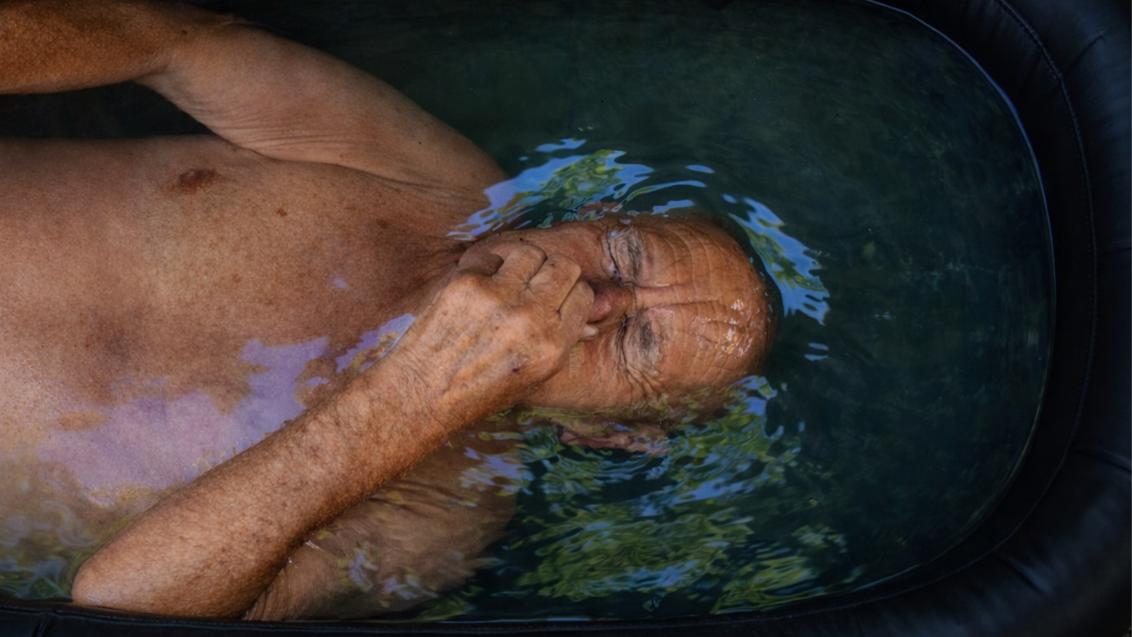 ¿Por qué hacer crioterapia si tenés más de 40 años?