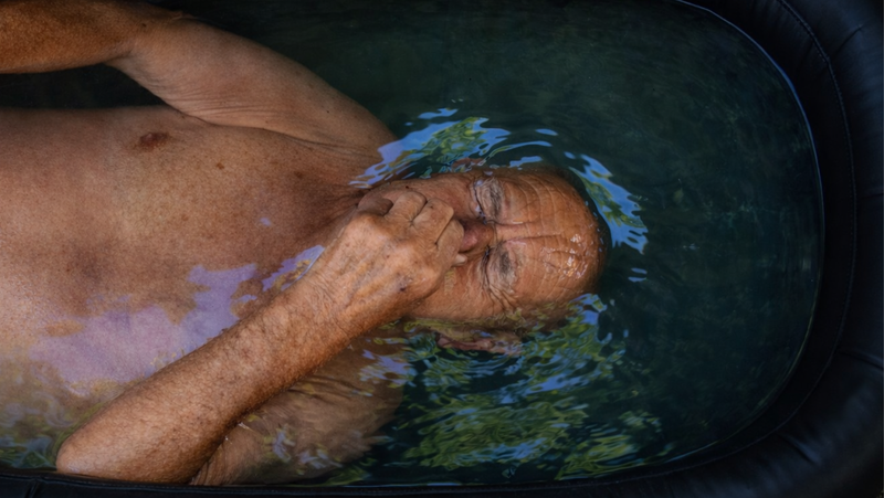 ¿Por qué hacer crioterapia si tenés más de 40 años?